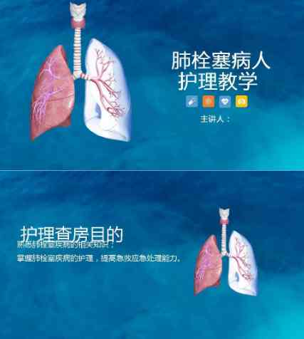 16呼吸内科-肺栓塞病人的护理