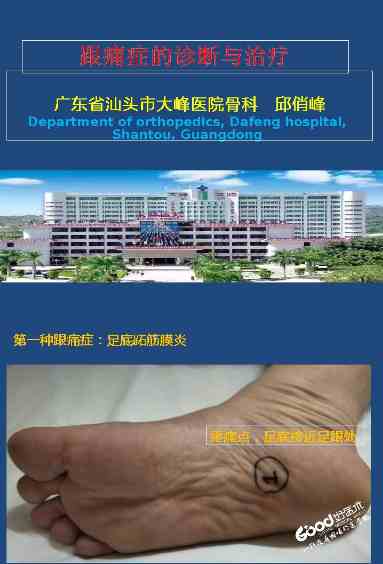 跟痛症课件