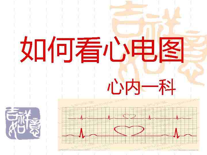 如何看心电图