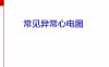 常见异常心电图