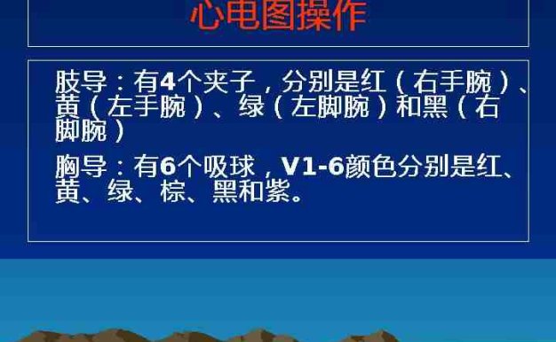 临床常见心电图教学图解