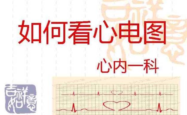 如何看心电图