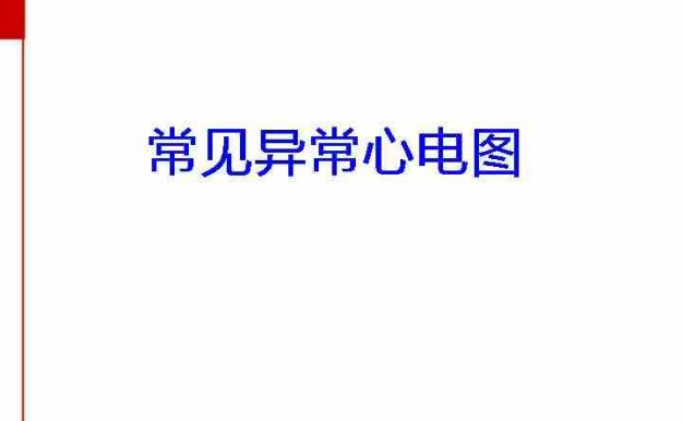 常见异常心电图