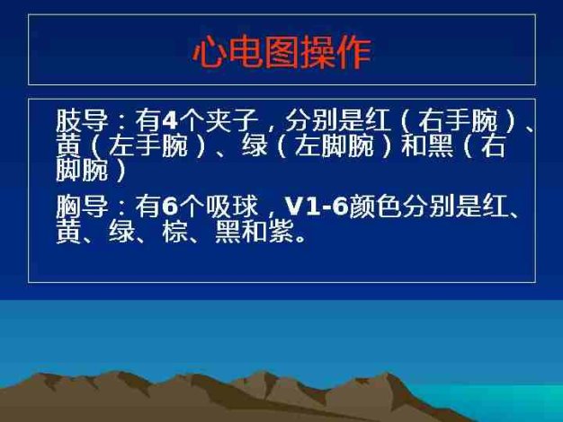 临床常见心电图教学图解