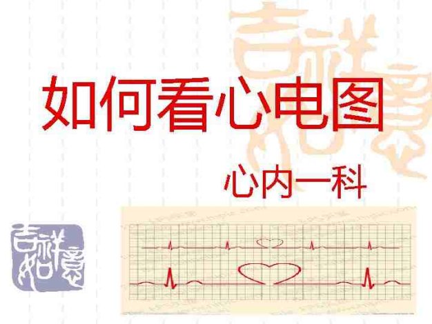 如何看心电图