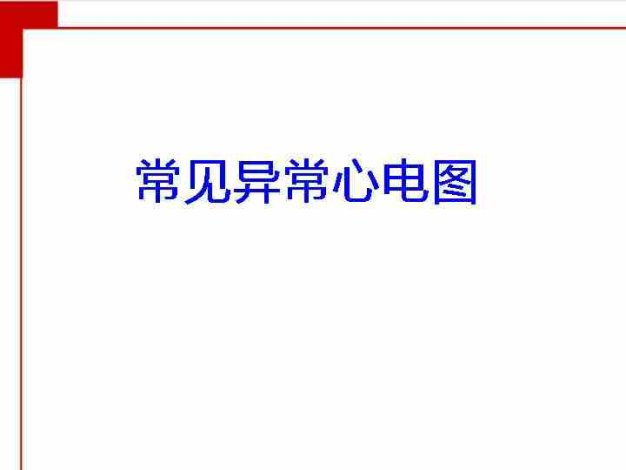 常见异常心电图