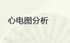 常见心电图分析