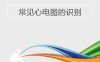 常见心电图的识别