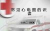 常见心电图的识读