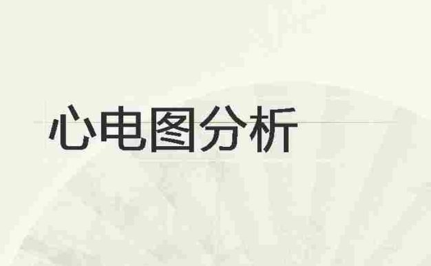 常见心电图分析