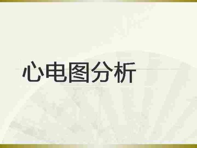 常见心电图分析